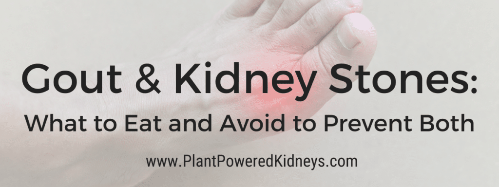 Gout and Kidney Stones: What to Eat and Avoid to Prevent Both
