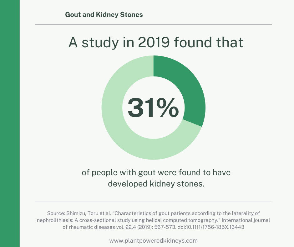Pie chart showing that 31% of people with gout have kidney stones, according to the NHANES survey of 2008