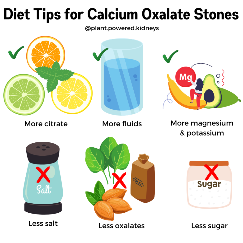 how-to-prevent-calcium-kidney-stones-buildingcap