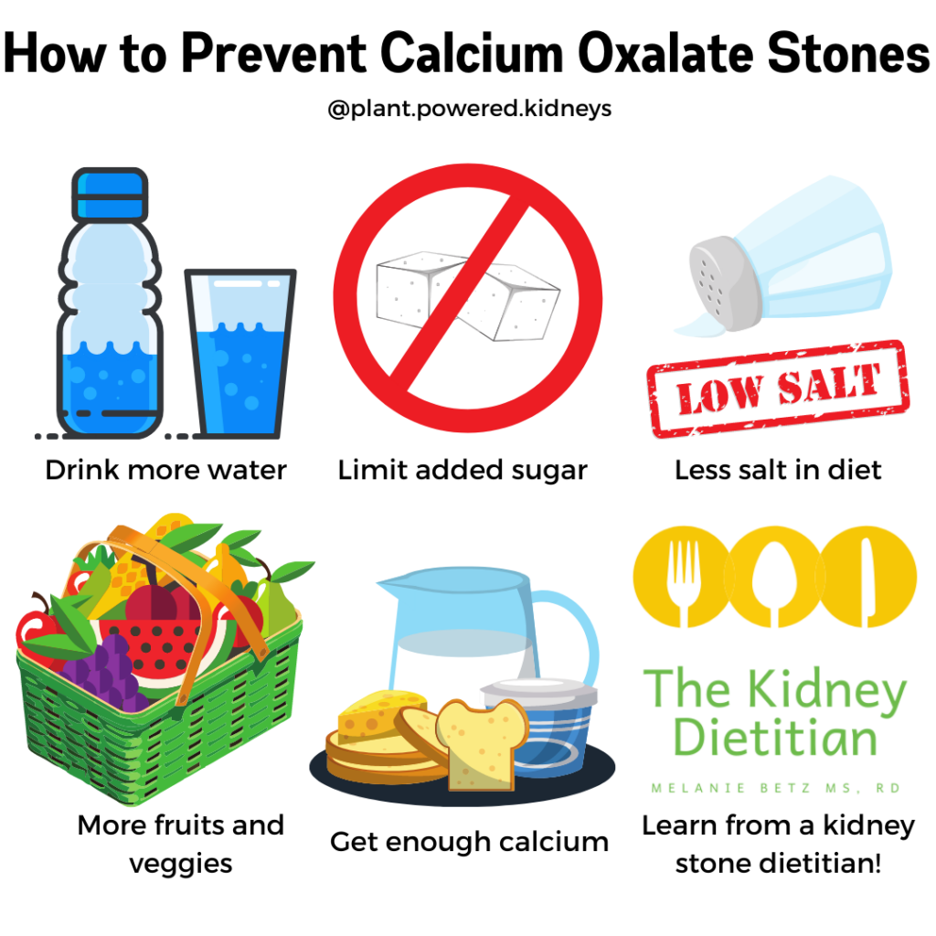 how-to-avoid-a-kidney-stone-plantforce21