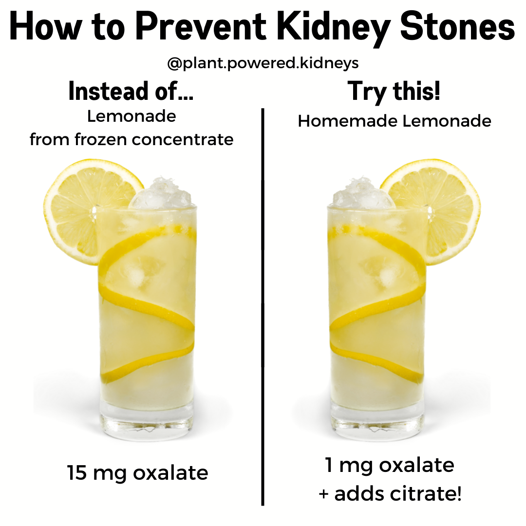 10 Tips to Prevent Kidney Stones Naturally